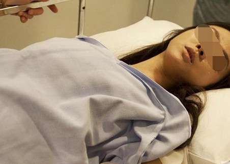 胎儿分娩用吸引器,新生儿难产负压吸引术