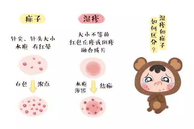 爽身粉到底要不要用应该用什么,为什么现在不提倡用爽身粉