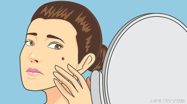 痣短期变大一定是恶化吗,医生能否判断痣是否正常