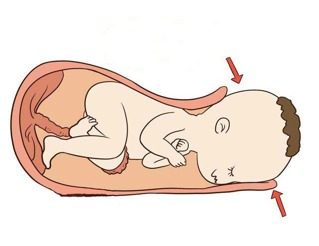 顺产和剖腹产到底哪个更好,一胎剖腹产二胎顺产三胎顺产快吗