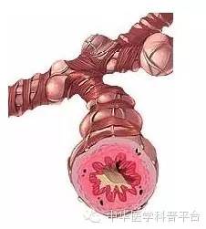 支气管哮喘的用药有哪些,哮喘每周一次连续两年的治疗