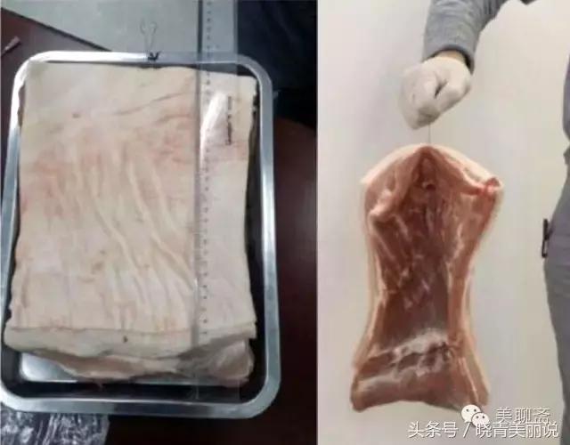 脸垮是先提拉还是填充,脸垮做什么医美没套路