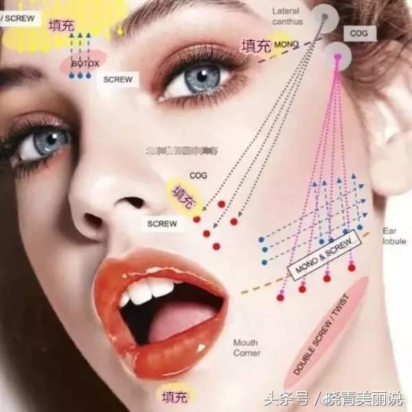 脸垮是先提拉还是填充,脸垮做什么医美没套路