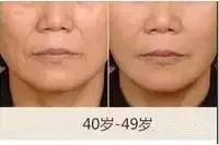 最靠谱的除皱产品,什么除皱效果好又平价