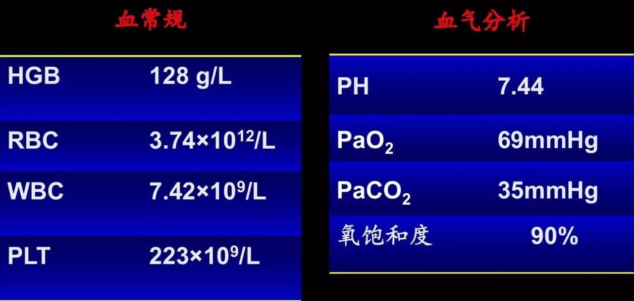 喘息、呼衰1年，问病史才发现是这个病！
