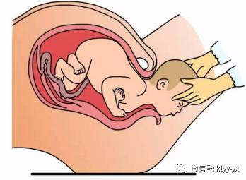 分娩时会检查会阴长短吗,孕妇分娩过程中的阶段