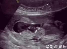 肚子咕噜咕噜叫是宝宝动吗,肚子咕噜咕噜响宝宝在干嘛