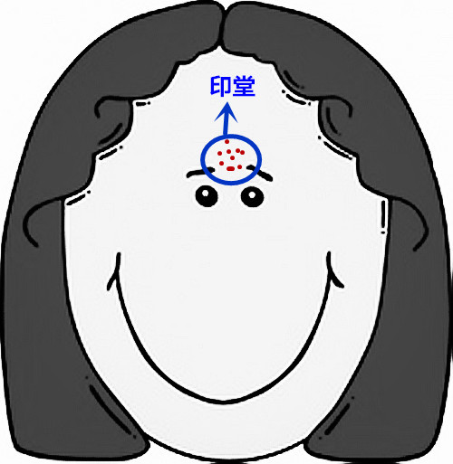 面部痘痘的症状图片和讲解,面部痘痘原因分析图片