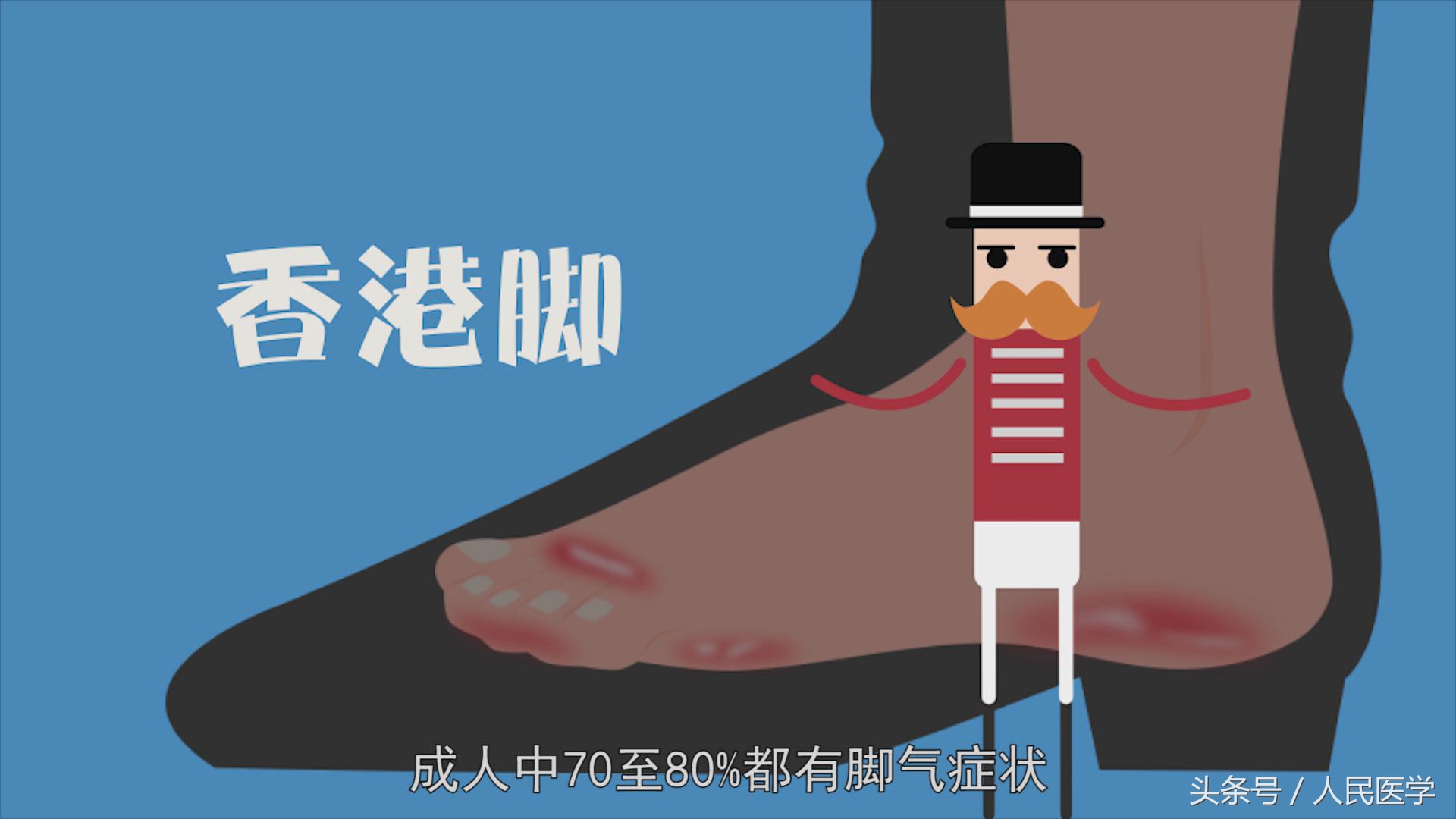 脚气被称作香港脚又叫什么,脚气与香港脚的区别