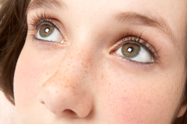 脸上长褐斑怎么快速消除,脸上大片褐斑怎么祛除