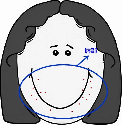 面部痘痘的症状图片和讲解,面部痘痘原因分析图片
