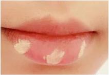 澶槼鐨勫悗瑁斿畫鎱т箶鐪肩嚎鐢绘硶,瀹嬫収涔斿お闃崇殑鍚庤鐪煎