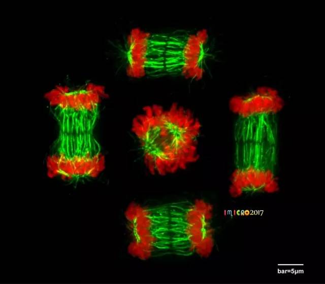 微观星球显微镜下的奇妙世界,显微镜下的奇妙世界视频