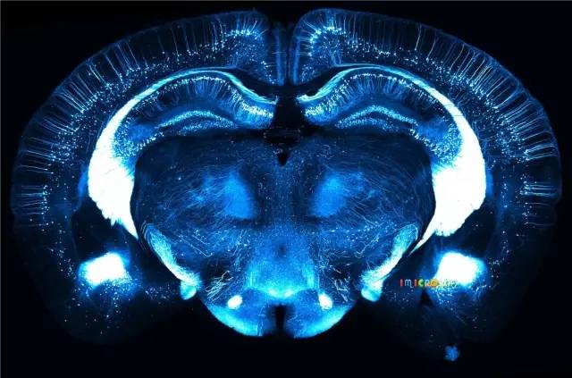 微观星球显微镜下的奇妙世界,显微镜下的奇妙世界视频