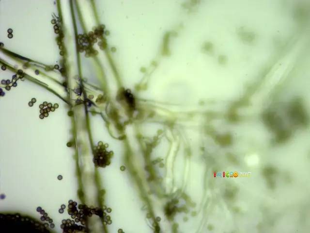 微观星球显微镜下的奇妙世界,显微镜下的奇妙世界视频