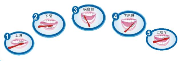 鼻咽癌化疗中口腔烂怎么办,急性白血病化疗患者口腔护理