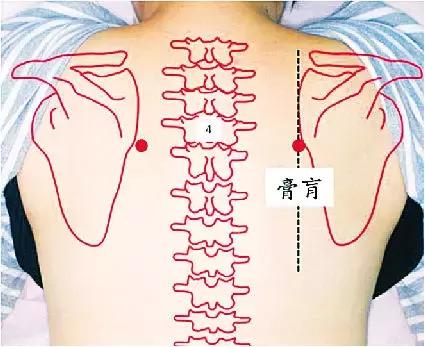 膏肓穴为什么对人体的健康很重要,病入膏肓指的是膏肓穴吗
