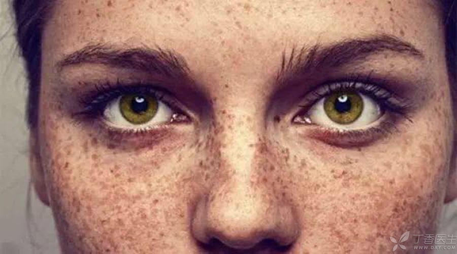 脸上长斑应该如何调理才能祛斑,脸上长斑最有效的祛斑方法