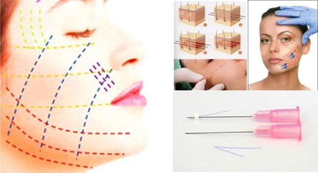 pst面部提升和拉皮手术有什么区别,内窥镜面部提升手术有什么危害