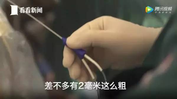 捐卵，被明码标价的青春｜关于捐卵应该知道的科普