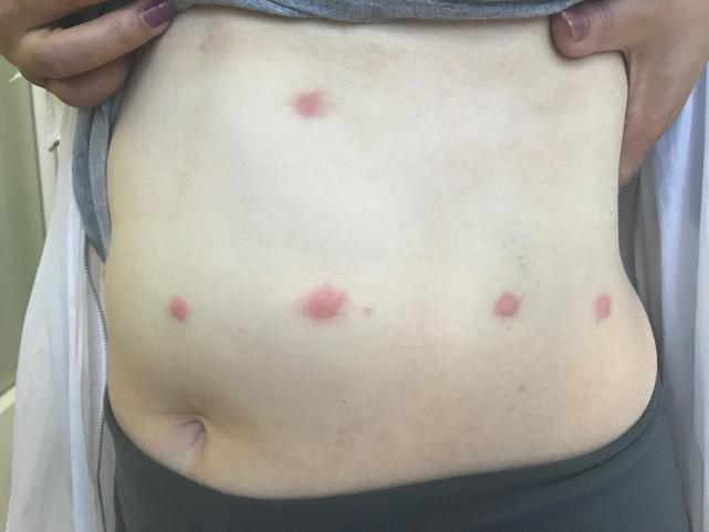 琚殜瀛愬拰璺宠殼鍜簡鏈変粈涔堝壇浣滅敤,琚殜瀛愭垨鑰呰烦铓ゅ挰浜嗚捣鍖呰秴绾х棐