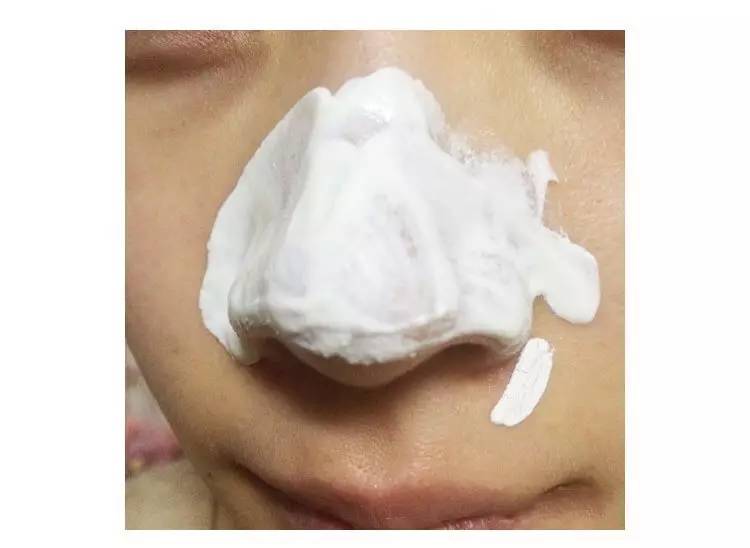 “黑头”这个渣男，彻底和他Say byebye~