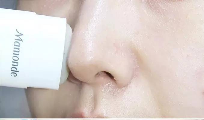 “黑头”这个渣男，彻底和他Say byebye~