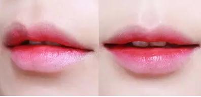 澶槼鐨勫悗瑁斿畫鎱т箶鐪肩嚎鐢绘硶,瀹嬫収涔斿お闃崇殑鍚庤鐪煎