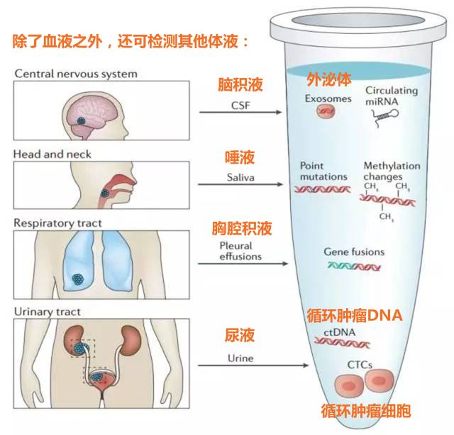 液体活检癌症筛查,癌症液体活检的趋势