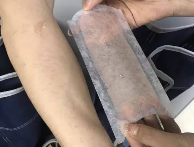 盘点好用的脱毛产品推荐,推荐好用脱毛产品