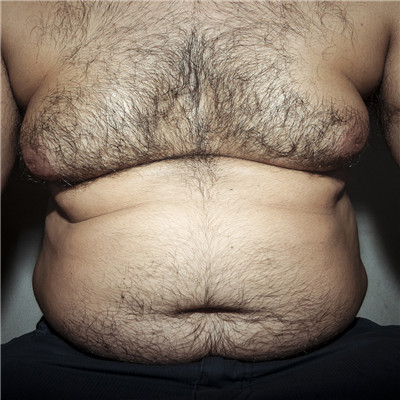 顽固性肥胖怎么瘦下来,顽固性肥胖怎么才能瘦下来