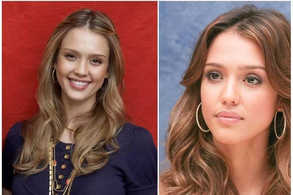 泪沟法令纹颈纹显老怎么办,改善泪沟法令纹全脸提升的方法