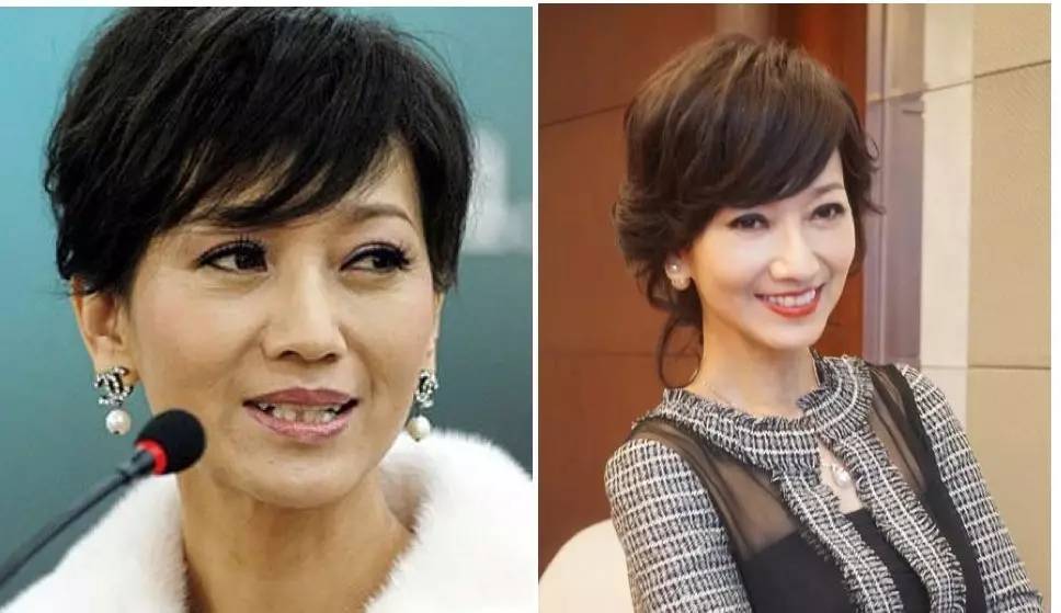 泪沟法令纹颈纹显老怎么办,改善泪沟法令纹全脸提升的方法