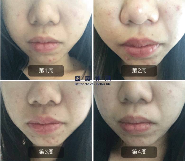 十大公认最好的美容仪,公认最好的美容仪推荐一下