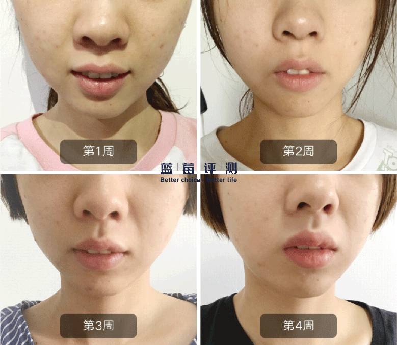 十大公认最好的美容仪,公认最好的美容仪推荐一下