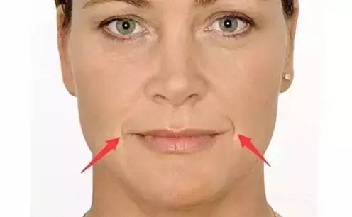 法令纹最简单的消除方法,法令纹消除的正确方法