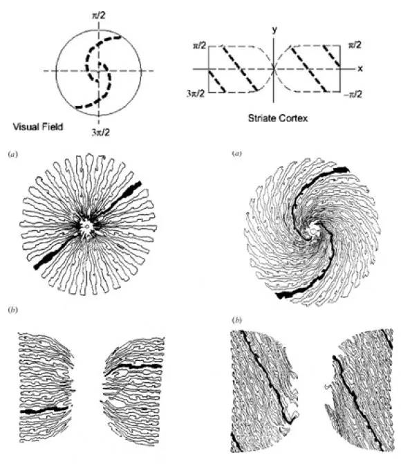 出现幻视怎么回事,老人幻视是怎么回事