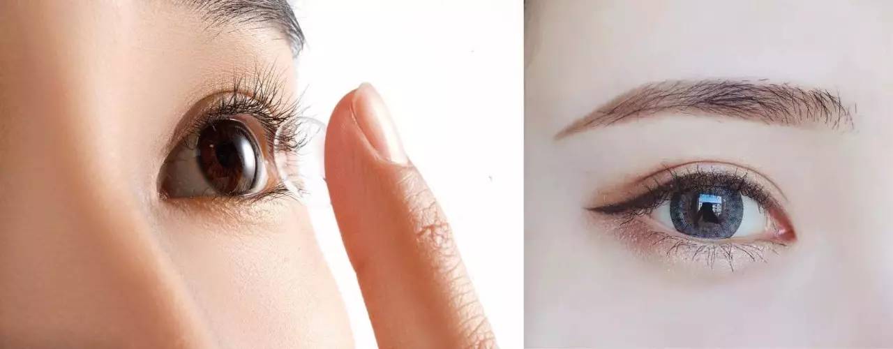 视力下降模糊要怎么保护,视力隐斜如何治疗