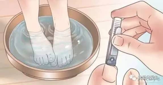 「实用」蒋源：尴尬了，您的灰指甲！