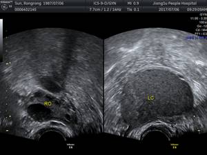 痛经的你要小心这六种疾病,痛经淤堵看过来