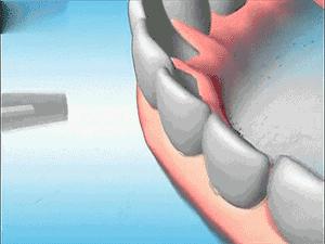 「爱牙日」牙龈出血、口腔异味、牙龈发炎……广东省中医院口腔科的这些“明星制剂”或能帮到您