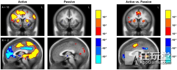 当他们还在骂《王者光荣》时，美国人却在用游戏治疗癌症