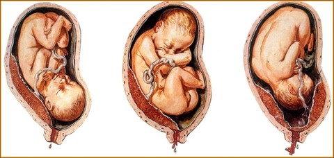 孕妇胎盘前置咋办,孕妈胎盘前置可以顺产的吗