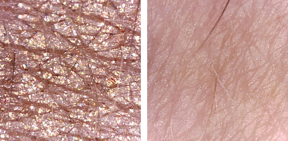 美容仪微整形图片,微整形注射美容仪