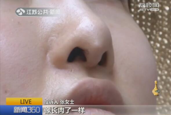 假体隆鼻有十天太细了,花三万块隆鼻