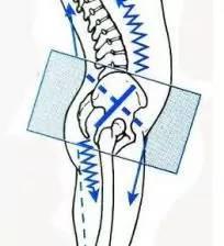 徒手整形许强分享：原来骨盆不正对女性影响这么大