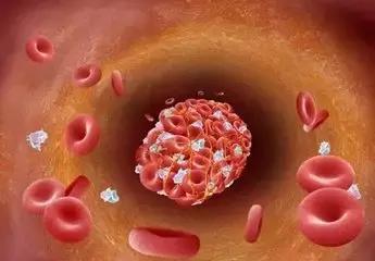 心梗直播间,心梗发病全过程视频