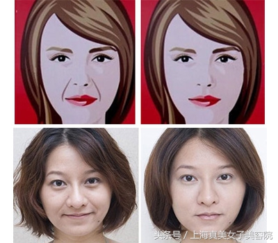 有了法令纹特显老教你1招立减10岁,法令纹消除立刻减龄5岁