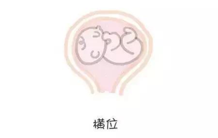 胎位不正如何纠正胎位,胎位不正纠正胎位最快方法