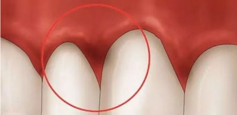 娌荤枟鐗欓緢鑲跨棝鐨勪腑鑽潗,鏇跨鍞戞不鐤楃墮榫堣偪鐥涘悧